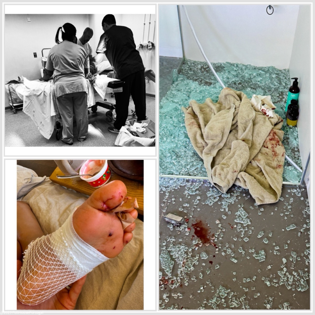shattered shower glass in a Portuguese condominium, child in the hospital, stitched up foot. Healthcare in Portugal.